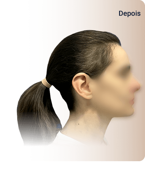 Clínica HA -Transplante Feminino